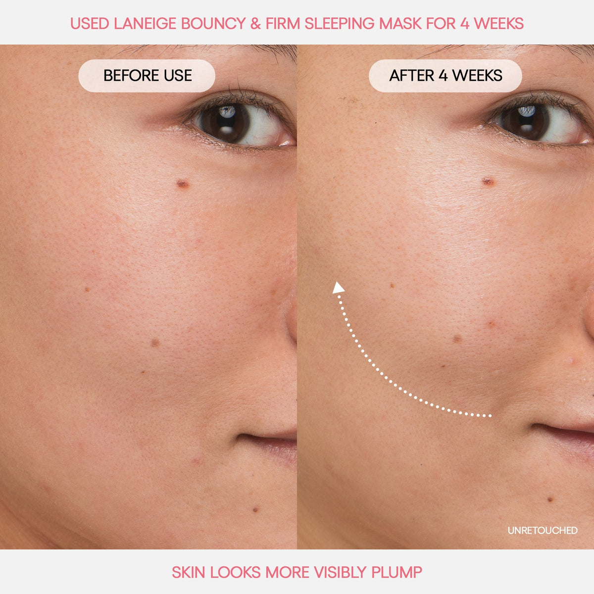 Bouncy Skin On The Go